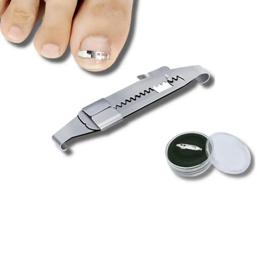 

Ingrown Toenail Correction Brace Kit Professional Toe Nail Care Pedicure Manicure Clipper Fixer Recover Corrector Tool Recover