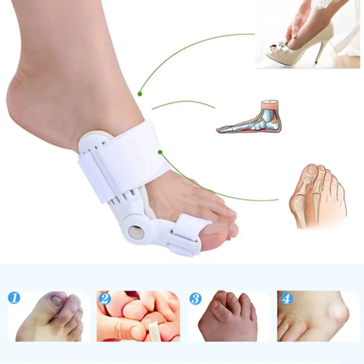 مصحح إبهام القدم