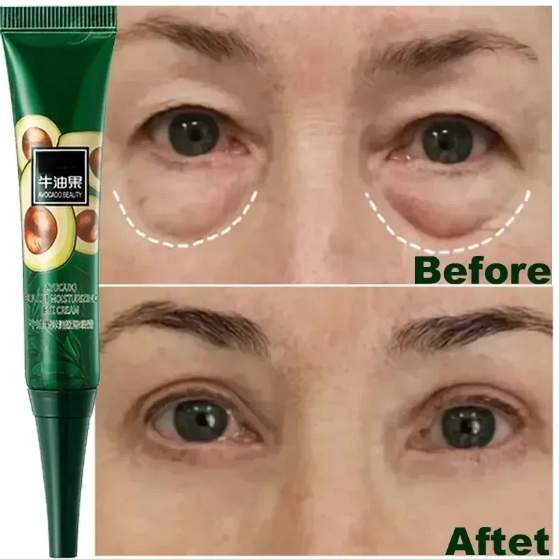 

Anti Dark Circles Bags Instant Remove Wrinkles Eye Cream Puffiness Fade Eye Fine Line Tighten Whiten Under Eyes Skin Care 2024