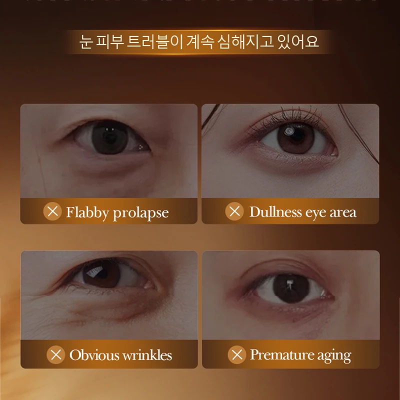 SADOER Rice Essence Eye Cream Anti Dark Circles Anti-Aging Anti Wrinkles Whitening Moisturizing Korean Eyes Skin Care Cosmetics