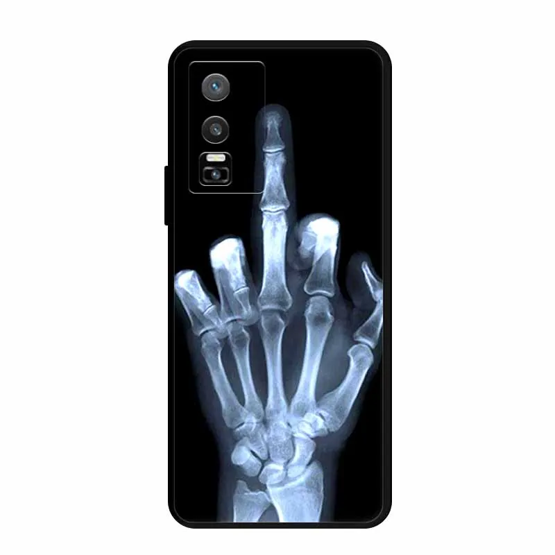 Animal-Themed Soft Silicone TPU Phone Case – Protective Back Cover & Bumper