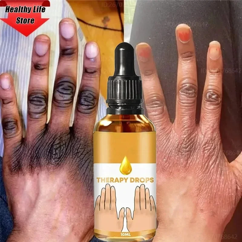 Dark Knuckles Brighten Serum Elbows Hand Knee Black Skin Stains Remover