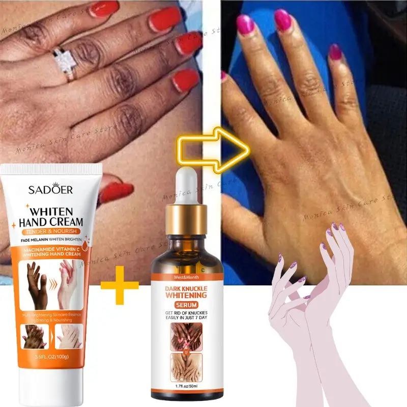 Effective Whitening Dark Knuckles Hand Serum Anti Cracking Cream Pigmentation Correctors for Black Skin Intense Stains Remover