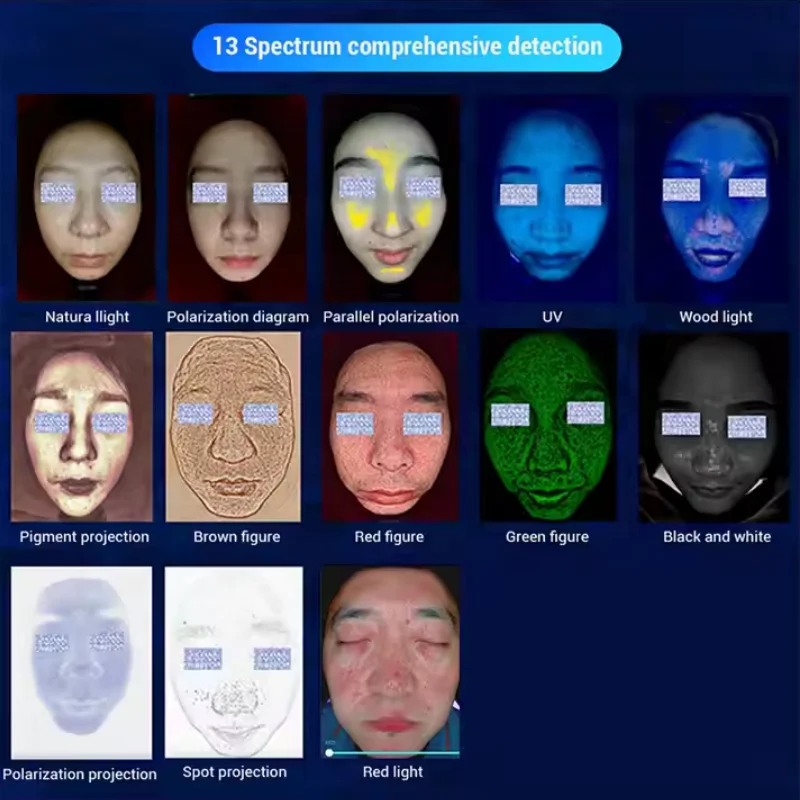 전문가용 16개 언어 지원 HD 픽셀 3D 디스플레이 AI 피부 스캐너 얼굴 테스트 진단 분석기 피부 분석 기기
