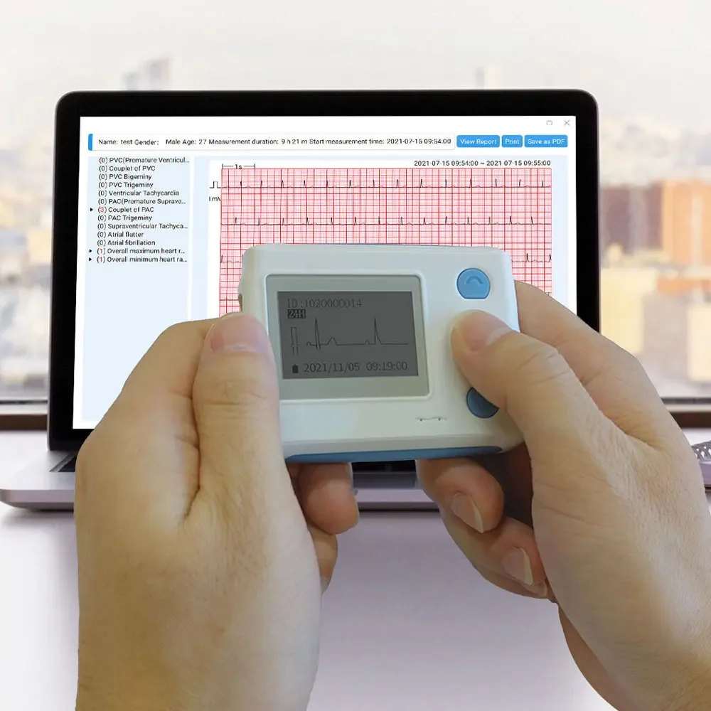 12-Lead Holter Monitor ECG EKG,24 Hours Dynamic ECG EKG Monitoring Detect Arrhythmias With AI Analysis