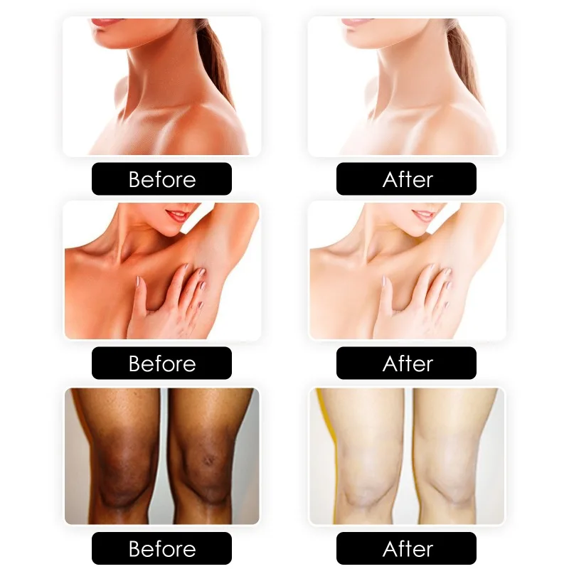 Skin Beauty Bath Soap Body Moisturizing Cleansing Joint Elbow Dark Spot Melanin Acne Reduce Brightening Whitening Body Skin Care