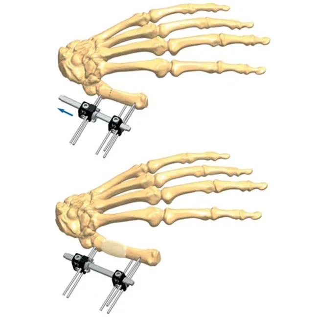 thumb