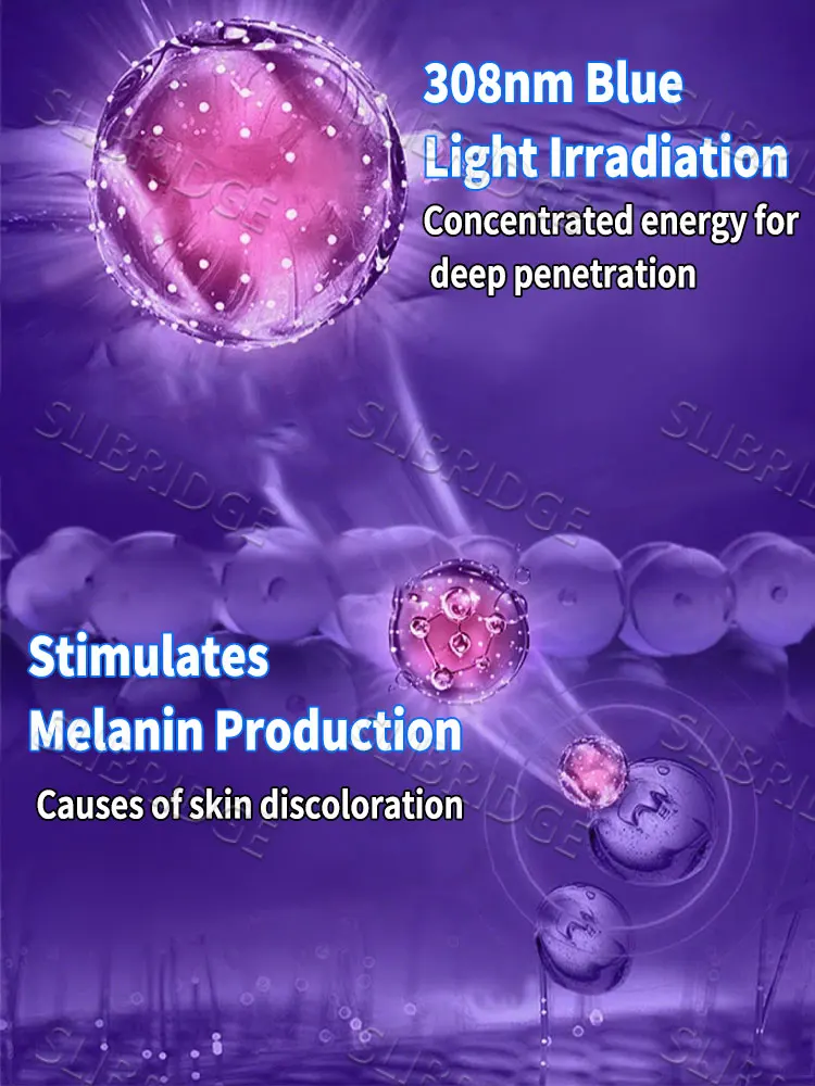 Penna a luce blu di seconda generazione (2025): strumento per risolvere il problema della vitiligine._voghion.com