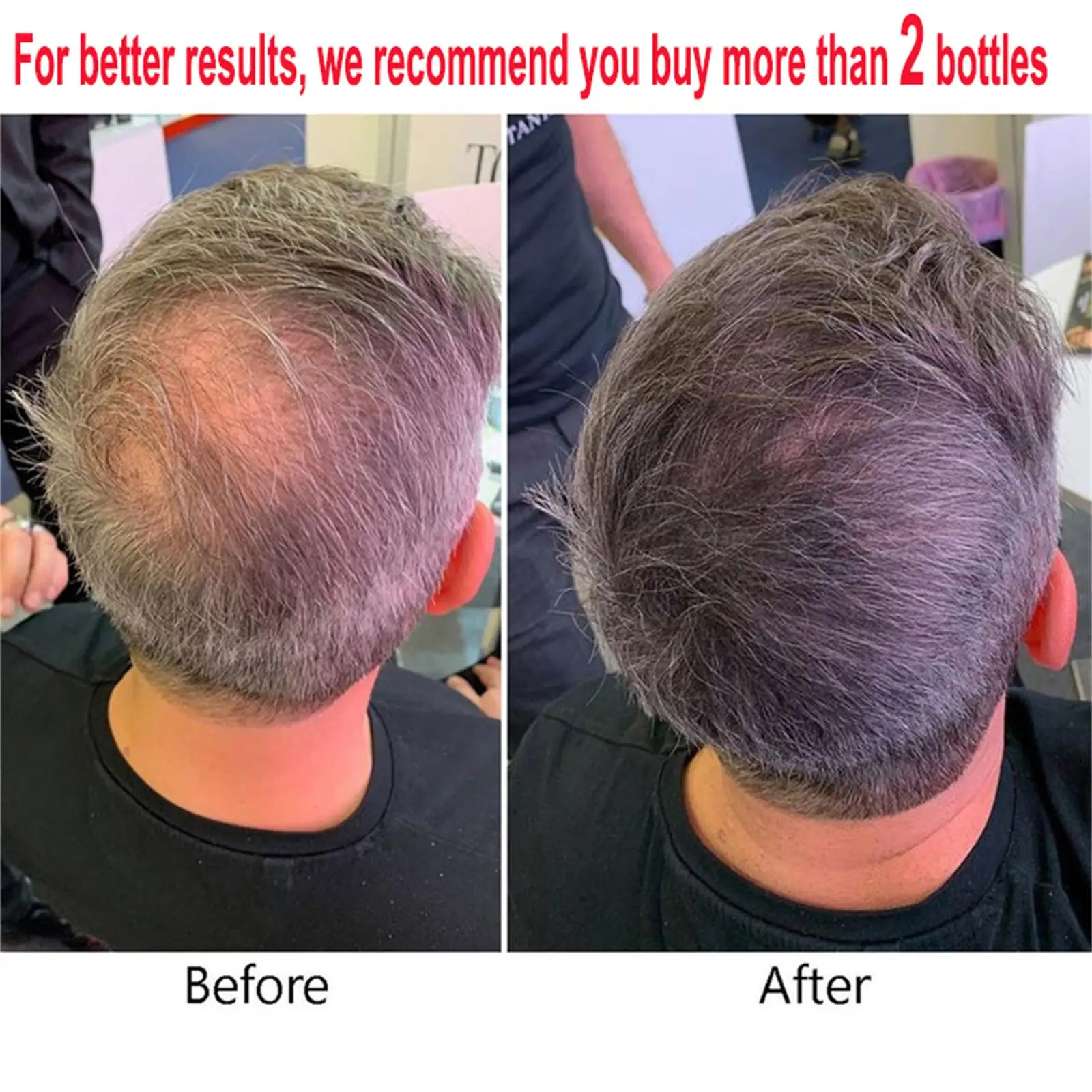 Description Picture 2 of itemPowerful Hair Growth Serum Spray Natural Anti Hair Loss Products Repair Nourish Hair Roots Fast Regrowth Hair Care Men Women