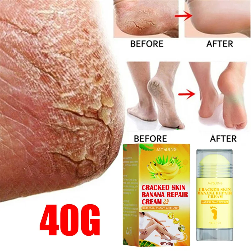 Anti Crack Foot Cream Cracked Heels Repair Calluses Dead Skin Remover