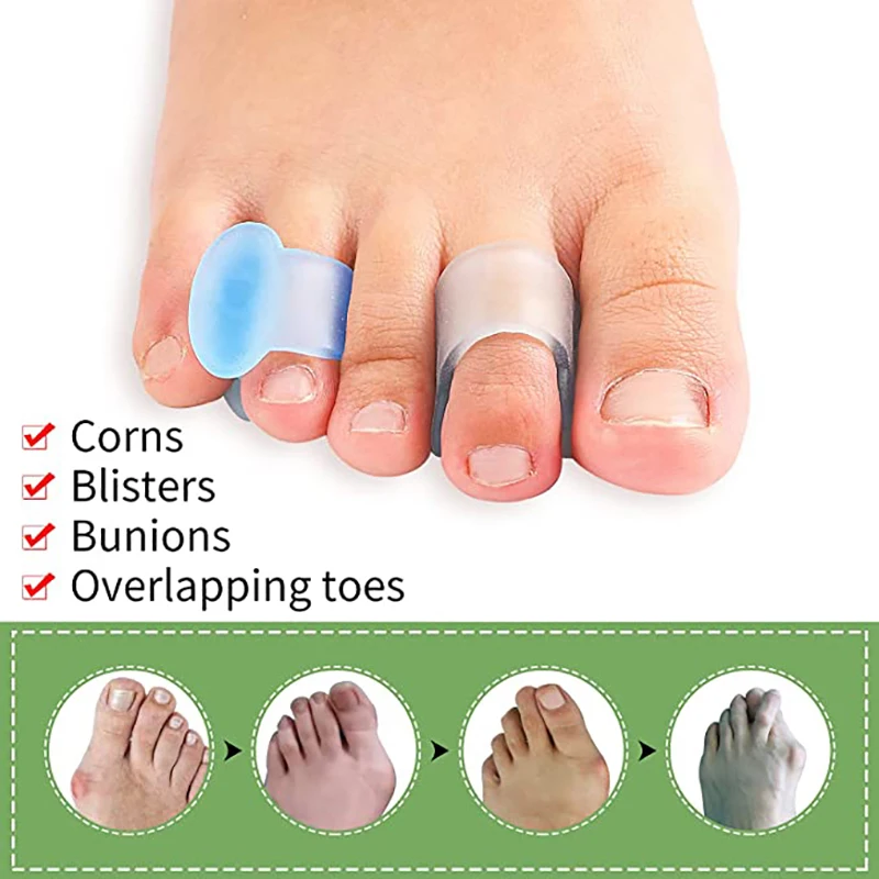 Toe Separators 4pcs=2pairs Silicone Separator Hallux Valgus Finger Protector Toe Orthopedic Products Corrector Feet Care Straightener Pedicure