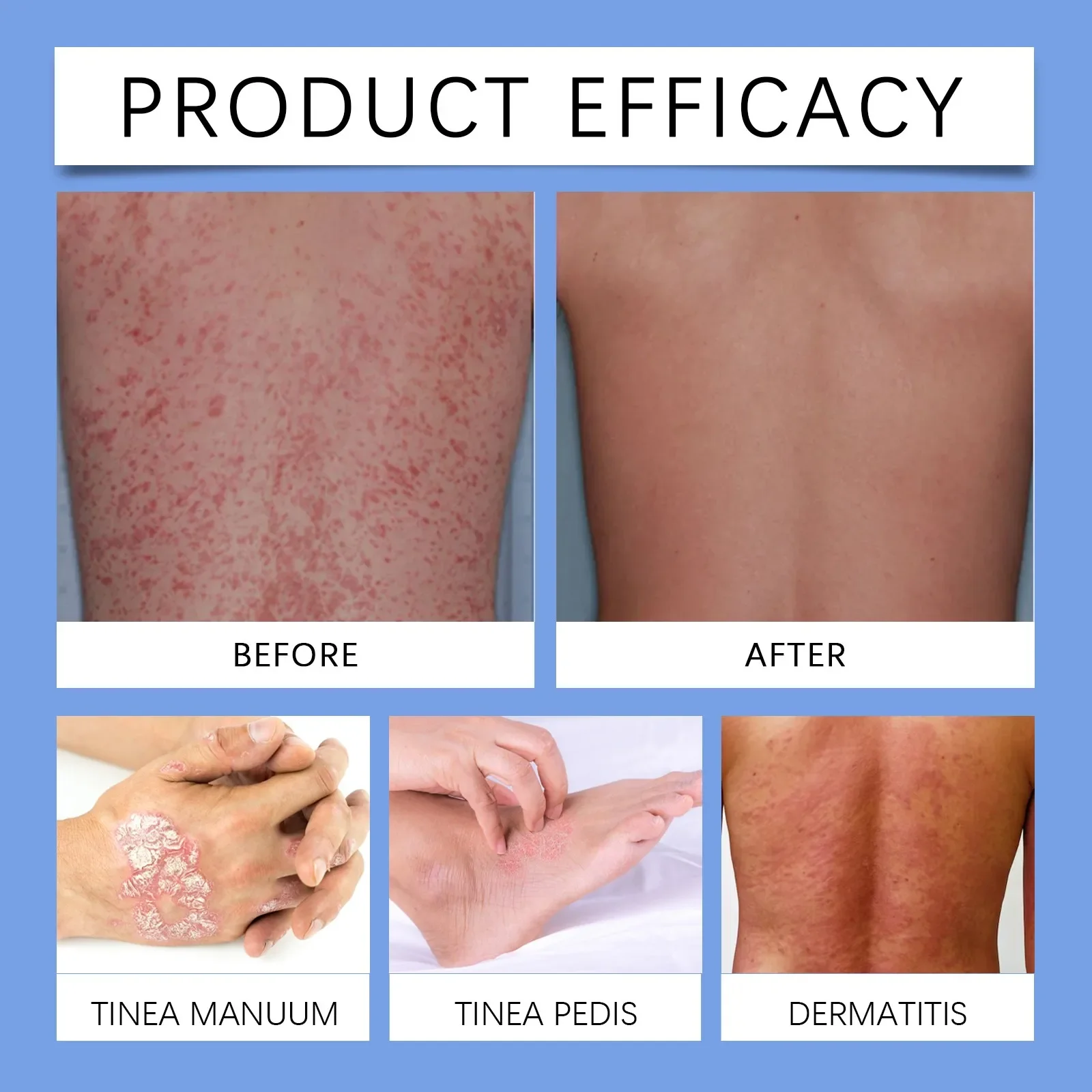 Skin smoothing spray 20ml delicate skin general external spray for skin smoothing mild bee venom reduces itchy spray for fast results
