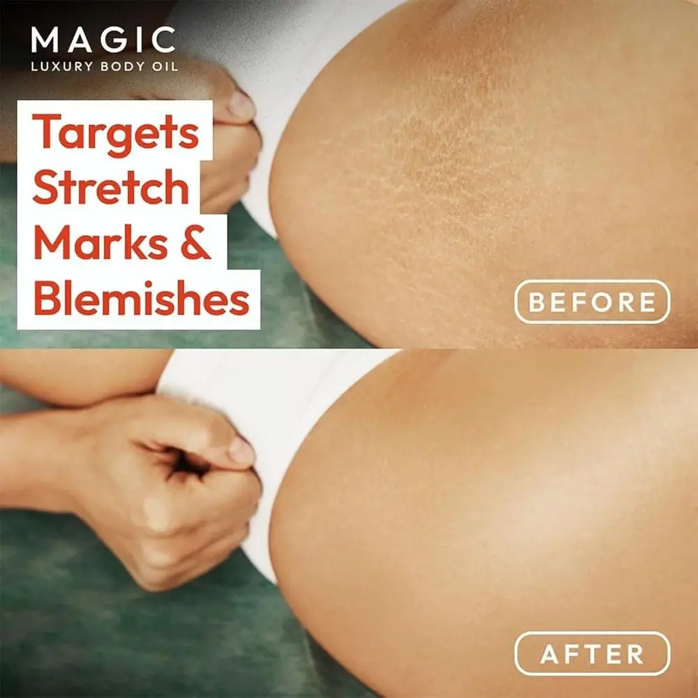 100ml Plumps Magic Body Oil Firms Hydrates Skin Magic Body Firming Oil Chest Thighs Tightens Moisturizer
