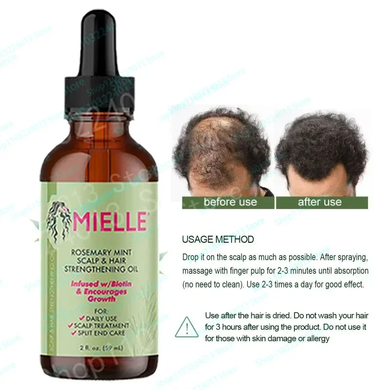 

Mielle Organics Hair Growth Essential Oils Rosemary Mint Hair Strengthening Nourishing Treatment For Split Ends And Dry Care