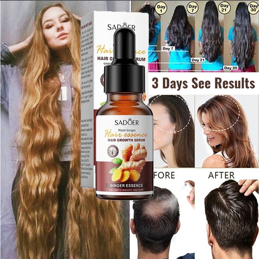 Ginger Hair Growth Oil Hereditary Hair Loss Seborrheic Alopecia Treatment Fast Grow Prevent Hair