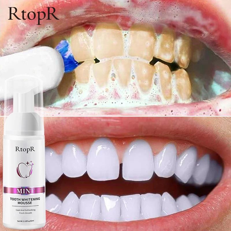 Rtopr Mousse Whiten Teeth Dental Smile Artifact Remove Tartar Plaque