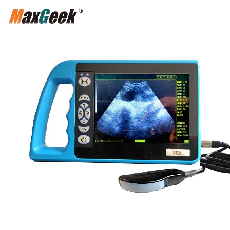 ecografo portatil de embarazo – Compra ecografo portatil de embarazo con  envío gratis en AliExpress version
