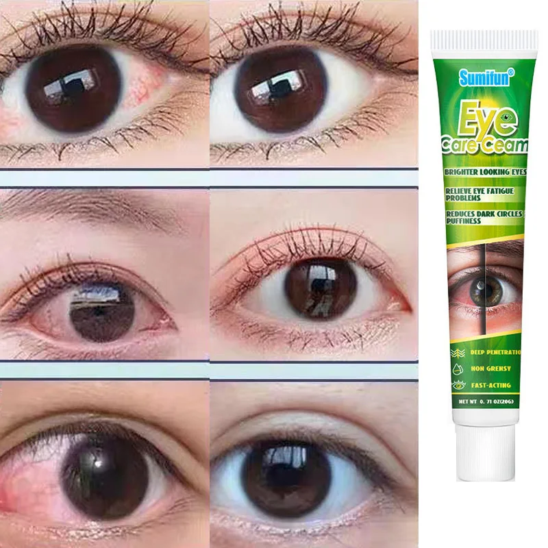 20g Chinese Herbal Medicine Eye Care Cream Brighter Looking Eyes
