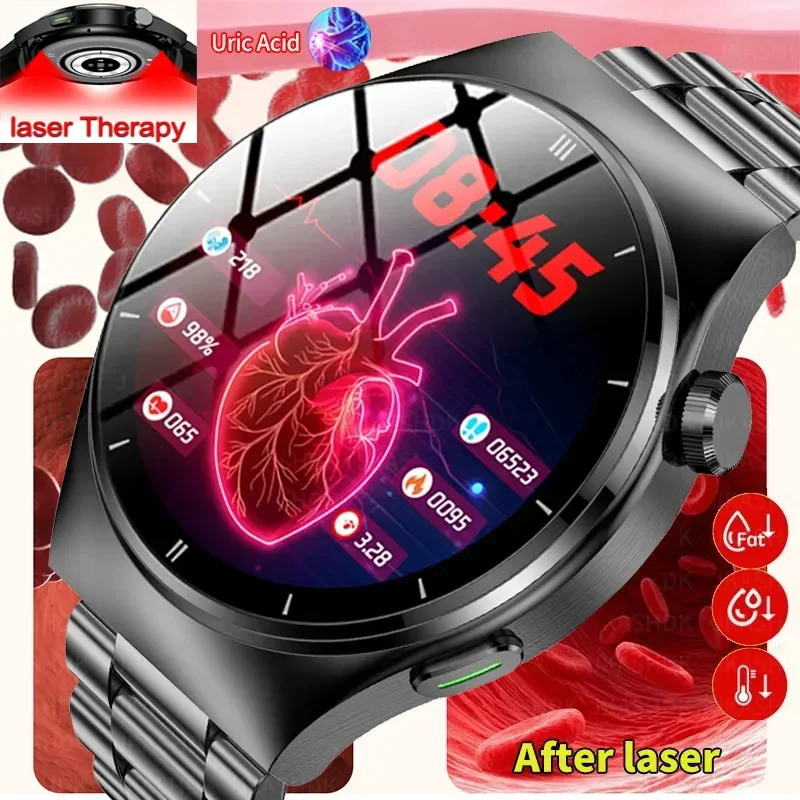 2024 Nuovo Trattamento Laser Tre High Smart Watch Men Frequenza Cardiaca Zucchero Nel Sangue Acido Urico Health Tracker Smartwatch Per Huawei Xiaomi