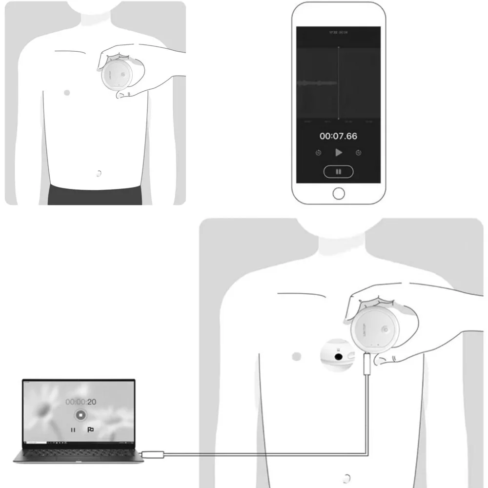Wireless Bluetooth Electronic Stethoscope Rechargeable Digital Stethoscope Support Heart And Lung Sounds Data Sharing