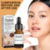 Lactobionic Acid Shrink Pores Facial Serum Improve Dark Dots Lifting Firming Fine Line Smooth Deep Nourish Brightening Essence 3