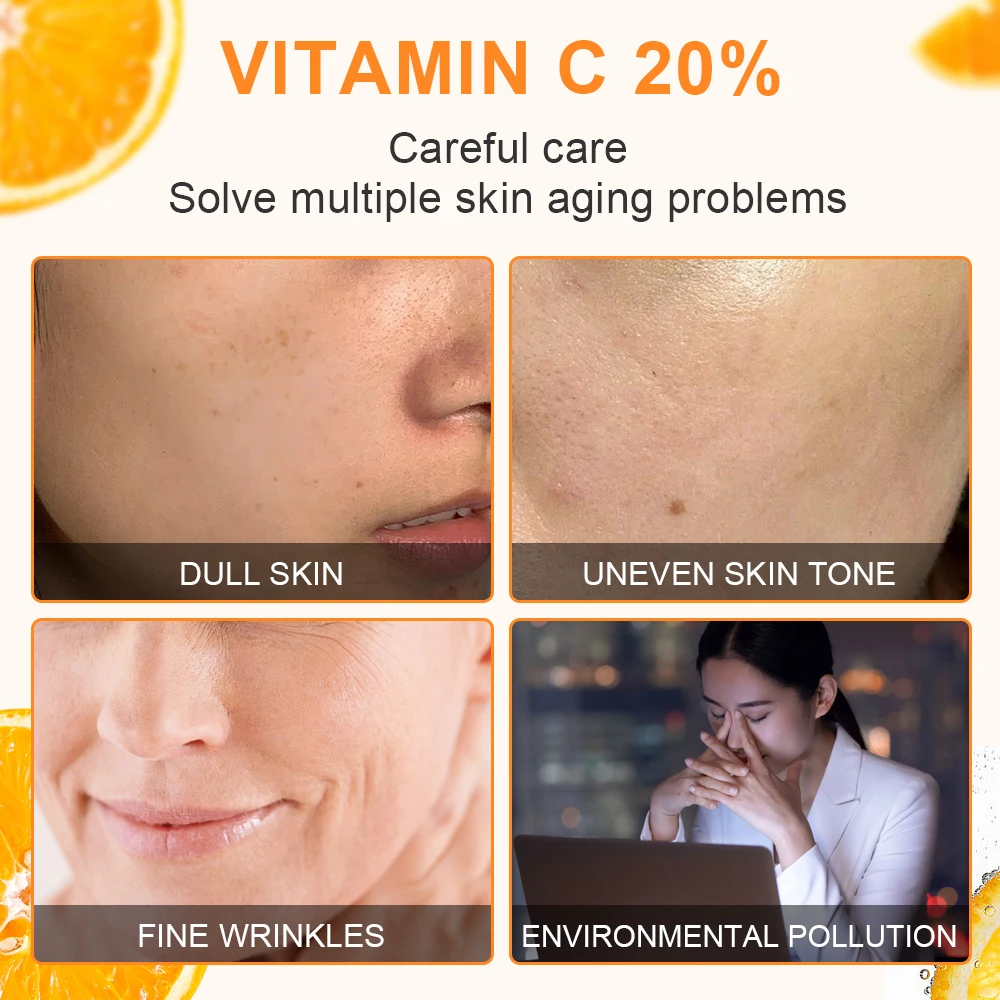 JoyPretty Vitamin C Face Cream Whitening Dark Spots Removal facial vitamin c cream