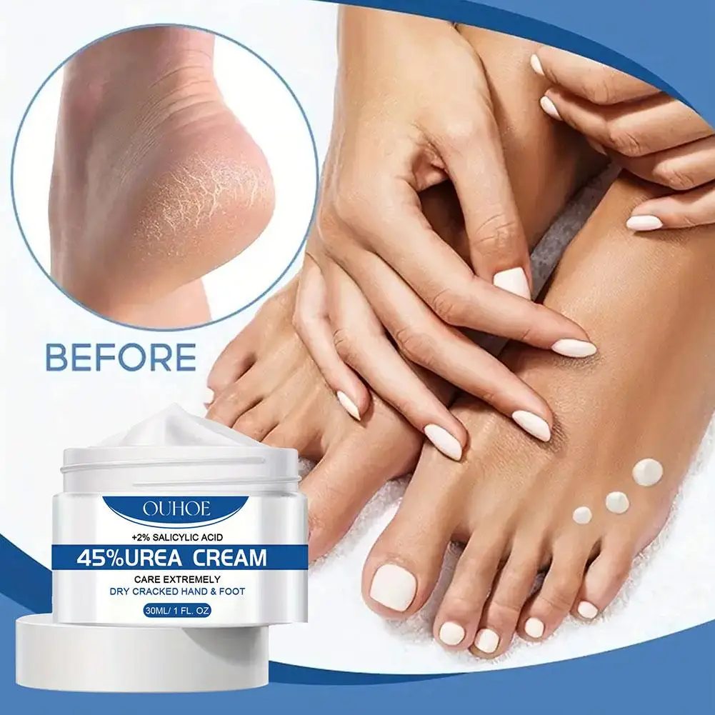 

OUHOE Hand Feet Care Cream Anti-dryness Remove Dead Feet Cream Hand Repair Care Skin Moisturize Heel Prevent Dry Skin Ruptu O7P5