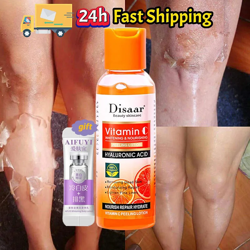 

﻿ 100ml Yellow Peeling Lotion Oil Bleach Dark Skin Remove Melanin Fast Whiten Cream Body Elbows Knee Finger Knee Joint Brighten