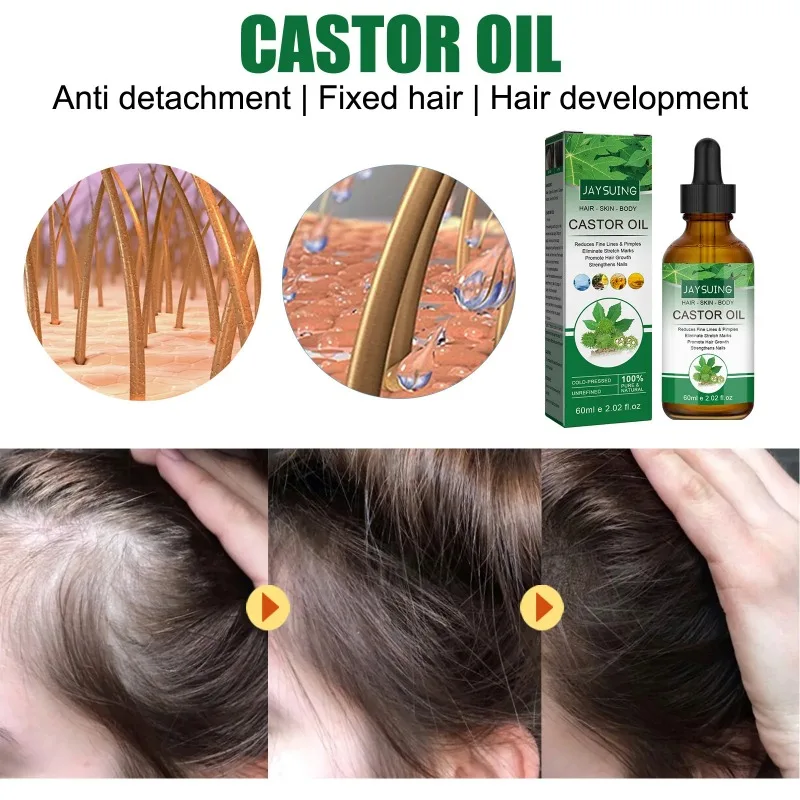 Description Picture 5 of itemHair Thickening Castor Oil for Hair Growth Treatment Preventing Baldness Anti Hair Loss Roots Shining Nourishing Enhancing Care