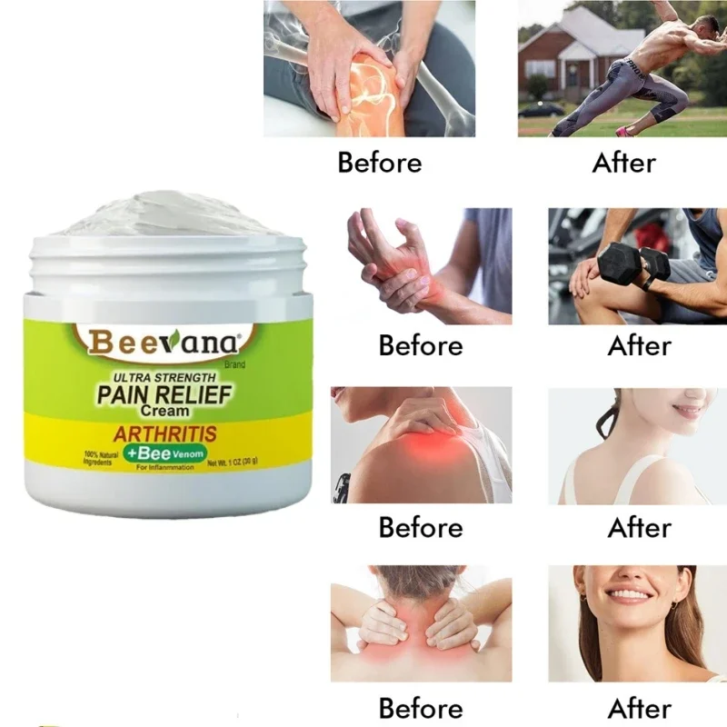 

30g Bee Venom Joint Cream Relief Pain Lumbar Spine Cervical Hand Foot Arthritis Analgesic Shoulder Neck Sore Body Massage Care