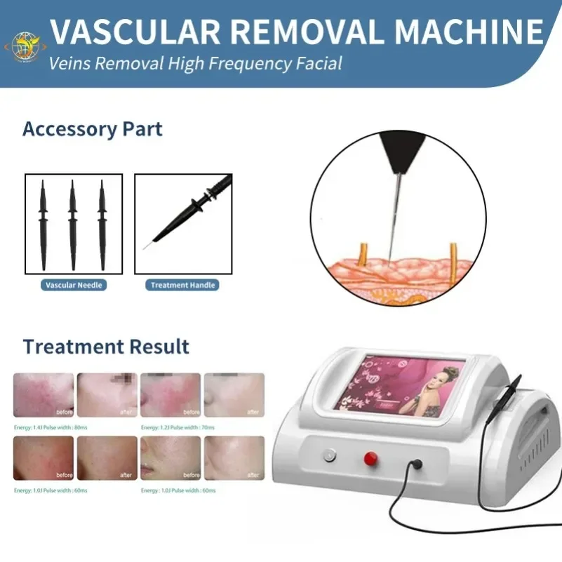 

Beauty Equipment Vascular Removal R-F High Frequency Machine
