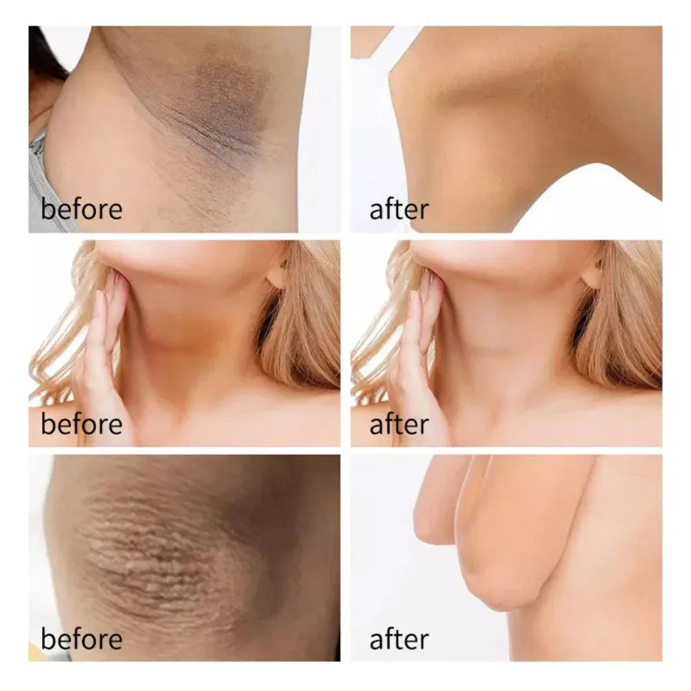 Body Lightening Cream Underarm Leg Knee Elbow Bleaching Cream To Improve Darkness and Remove Melanin Brightening Skin Care