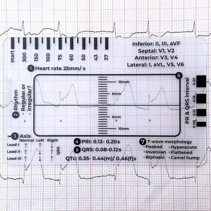 Measurement Tool Ecg 7 Step Ruler 7 Step Scale For Ecg Observation Portable Transparent 7step Ruler Measurement Tool For Interpretation