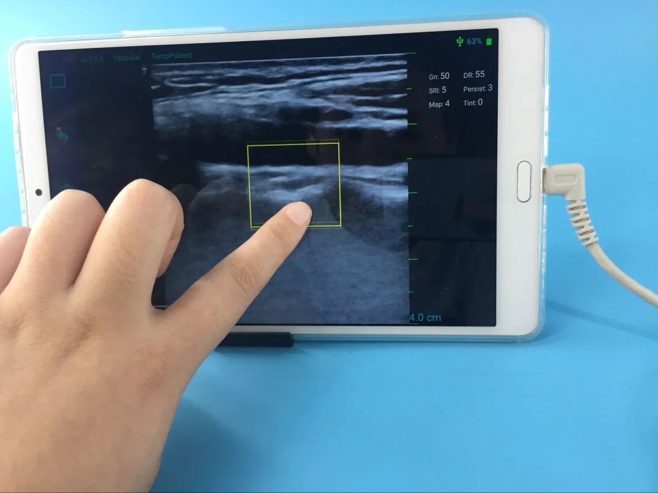Portable 7.5Mhz USB linear probe ultrasound transducer best price USB ultrasound probe