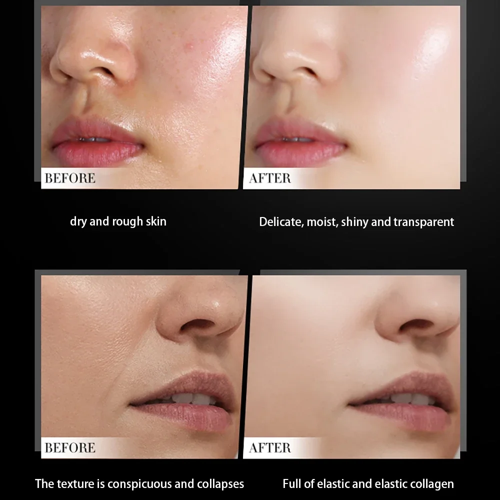 Conopeptide Collagen Revitalizing Lotion For Facial Care Brighten Firming Improve Sensitive Skin Face Lotion Skin Care emulsion