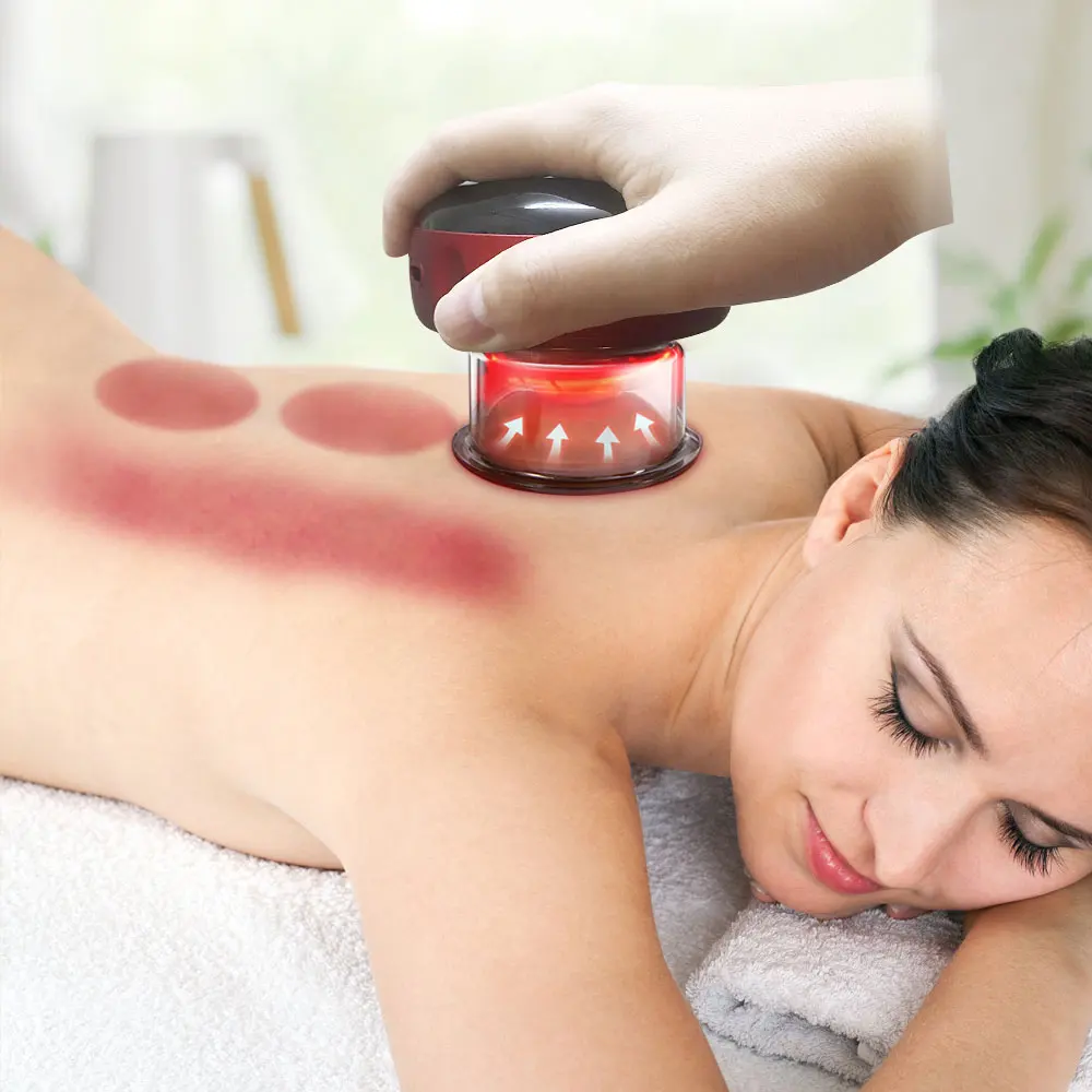 ventosas Cupping Vacuum Anti-cellulite Massager Professional Suction Cup for Body Masssage Physiotherapy Relaxation Treatment 5