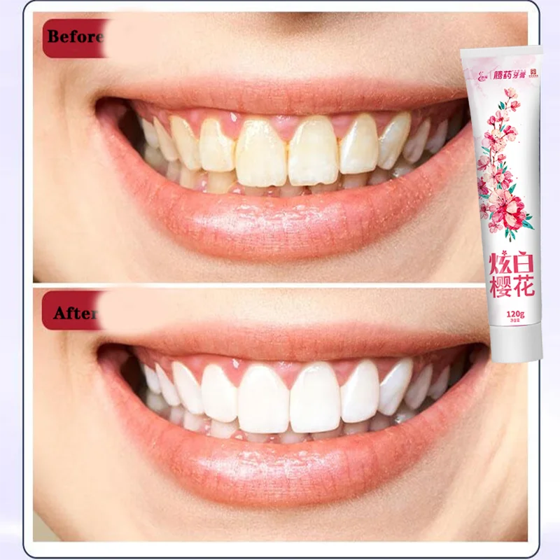 120g Whitening Removal Plaque Whitening ToothpasteOral Clean Care Removal Bad Breath Teeth Preventing Periodontitis Repair