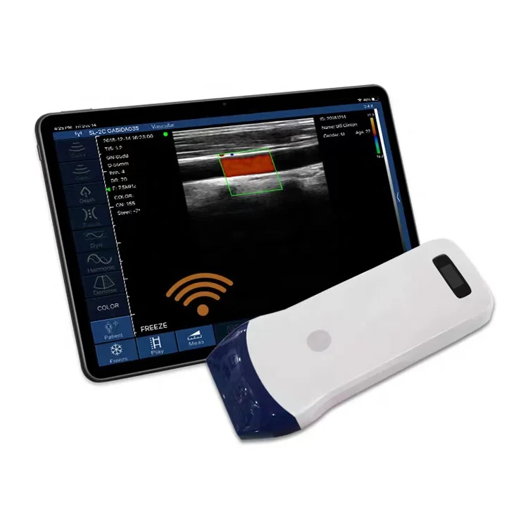 

Wifi Portable pocket Ultrasound Linear Probe Color Doppler Wireless Ultrasound For Android Phone Ipad