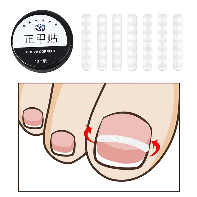 10pcs Ingrown Toe Nail Treatment Ingrown Toenail Correction Tool Elastic Patch Sticker Straightening Clip Brace Pedicure Tools