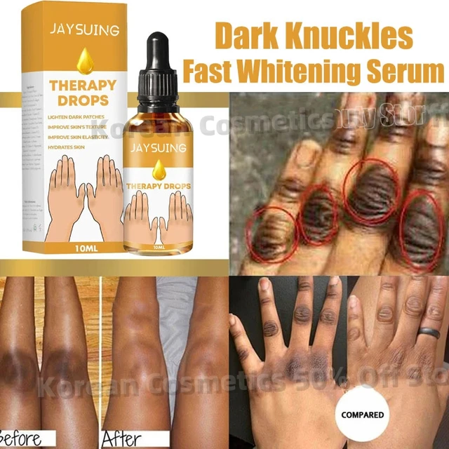 Joints foncés sérum éclaircissant rapide coudes mains genou aisselles sérum éclaircissant clarif la peau noire éclaircir les taches dissolvant Essence 1