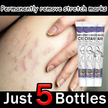 La cura delicata della pelle migliora l'elasticità efficace dopo la gravidanza Rimozione smagliature Potente crema premaman Nutre la pelle 1