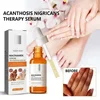 Dark knuckles whitening serum Elbows Armpit Beaching SerumWoman Private Part Skin Removal Dark Knuckles Strong Whitening Serum 1
