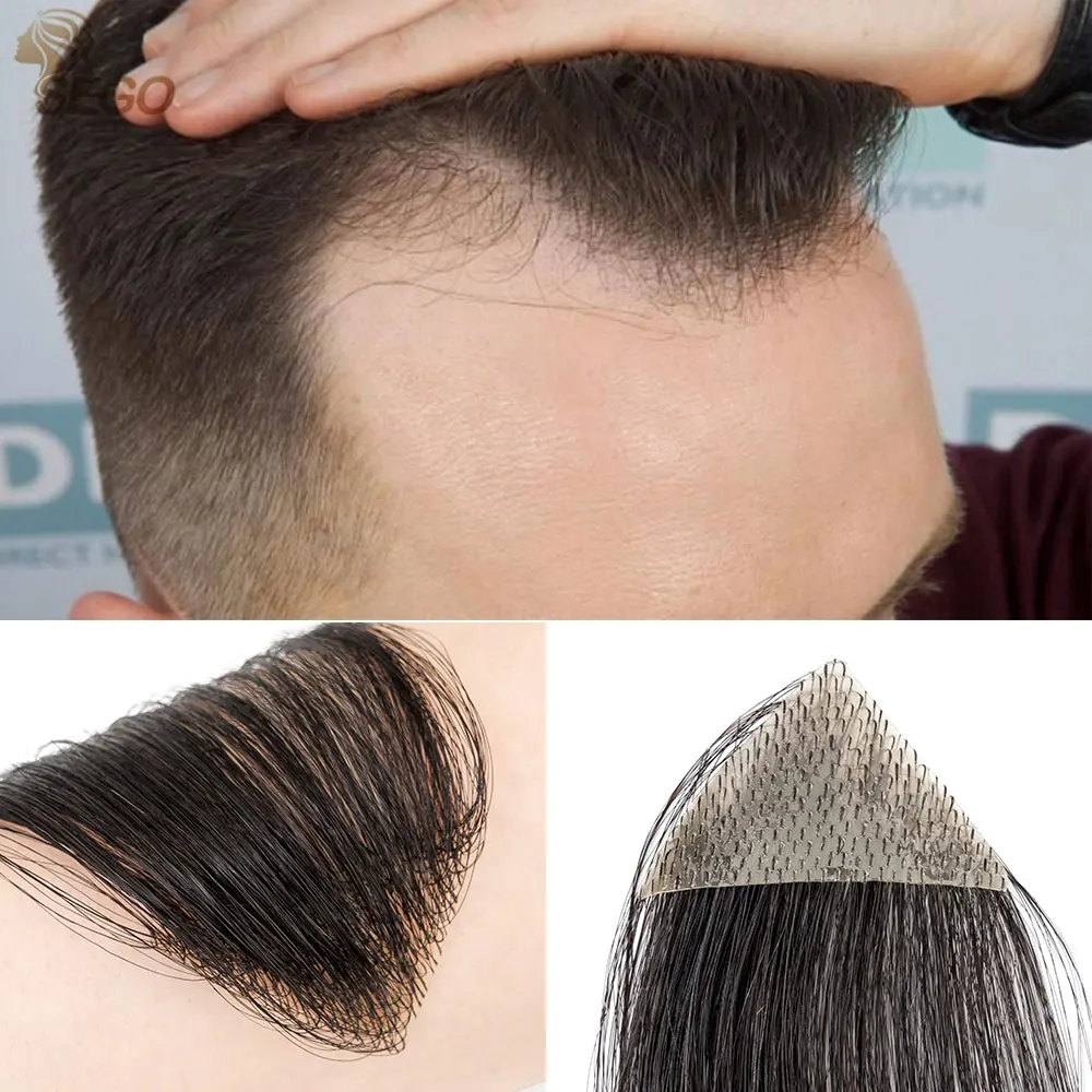 SEGO Human Hair Replacement Patch for Men Women Hairline Loss Straight Tape in Replacement Toupee human hair toupee