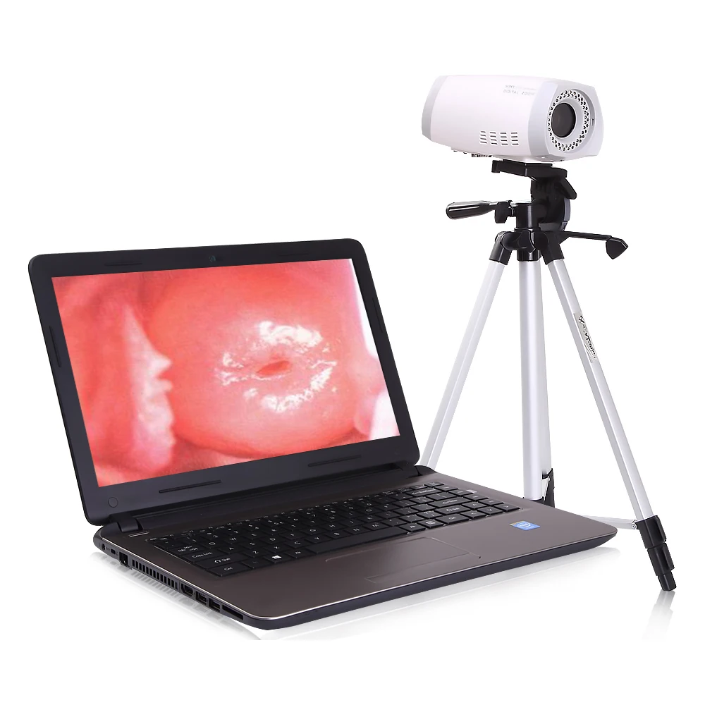 

Colpos cope для гинекологии HD colpos cope Video colpos cope для вагини, осмотр шеи, медицинское оборудование для больницы