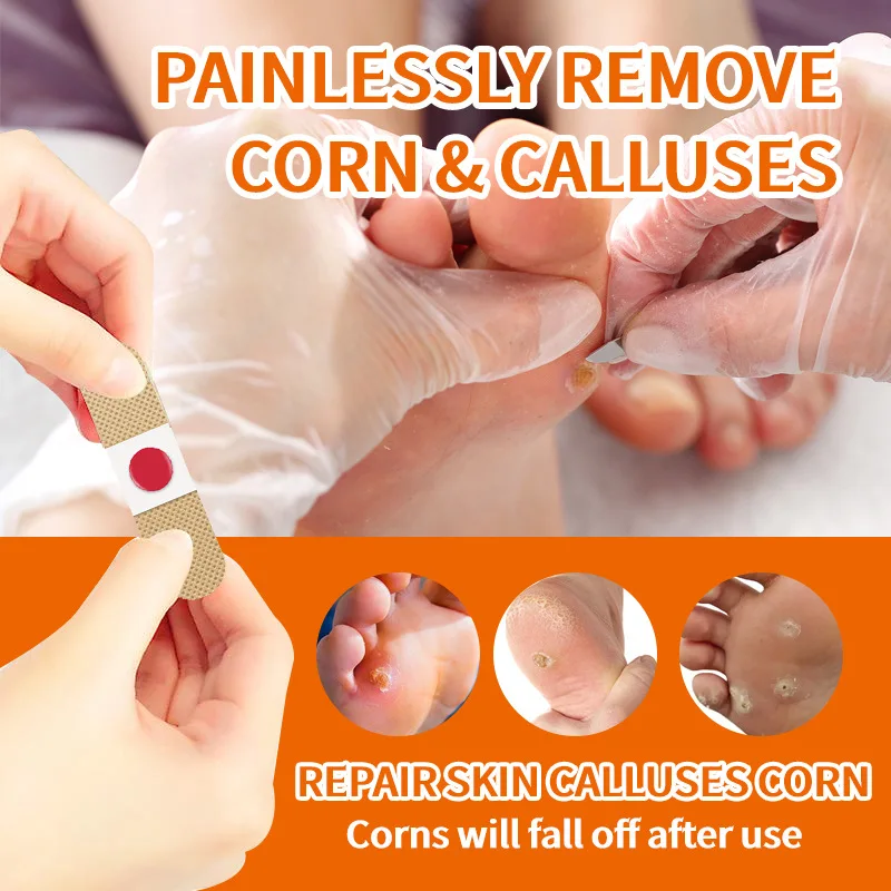 Chicken Eye Patch for Removing Corns and Calluses