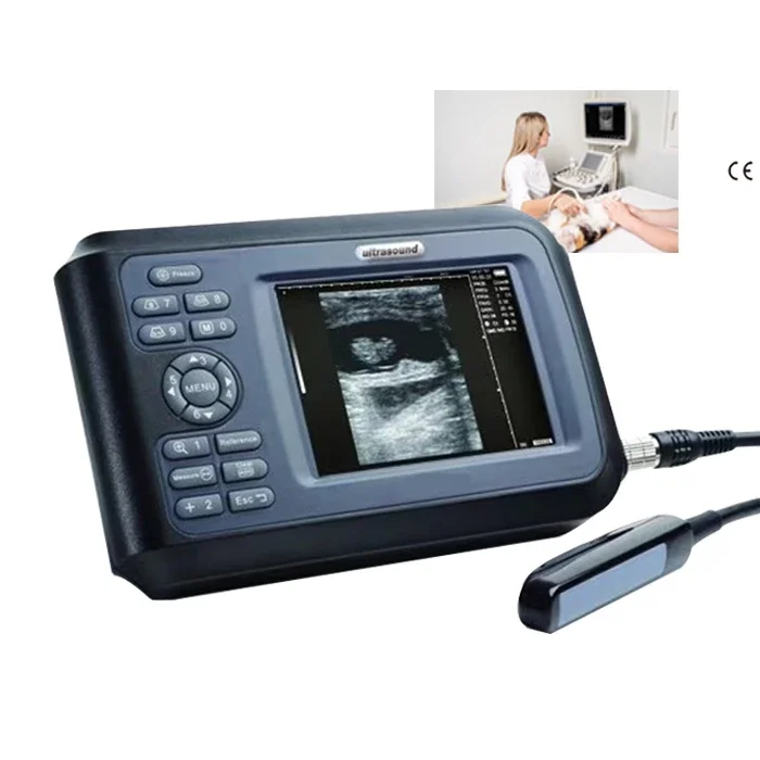 

Mini Handheld Cow Pet Ultrasound Animal Vet Veterinary Ultrasound Scanner