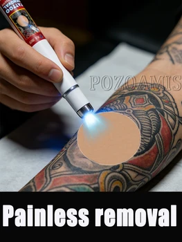 Instant Tattoo Removal Device 1