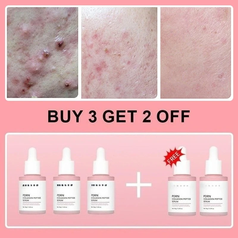buy 3 free 2