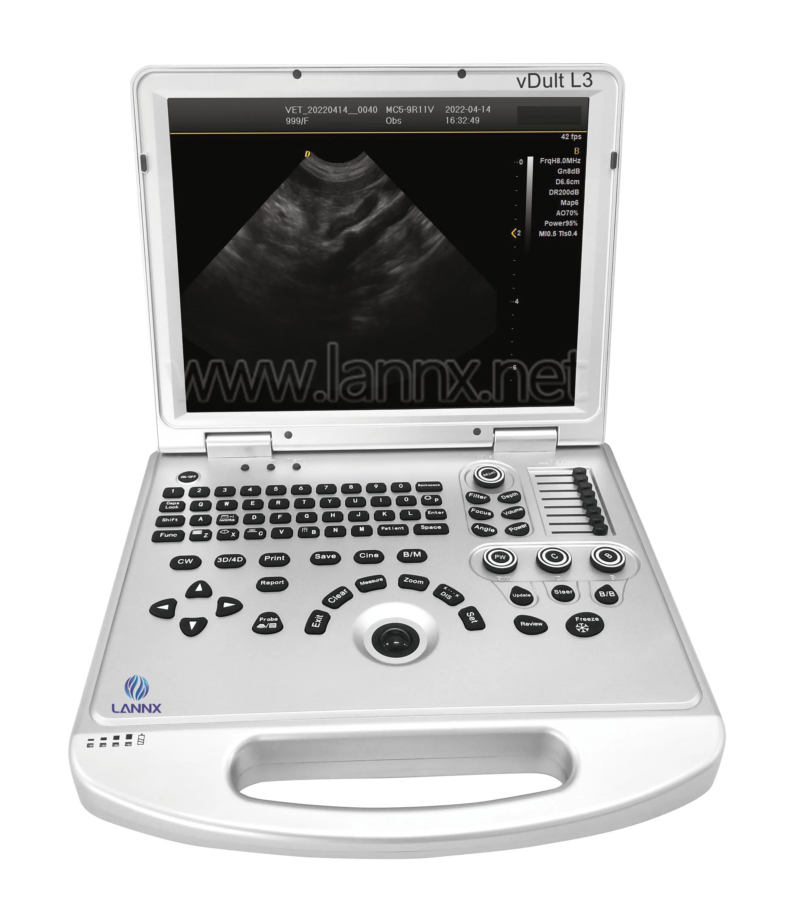 LANNX vDult L3 Animal Clinic Use Ultrasound Scanner Hospital