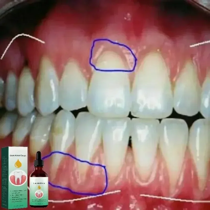 Gum Repair Drops